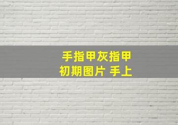 手指甲灰指甲初期图片 手上